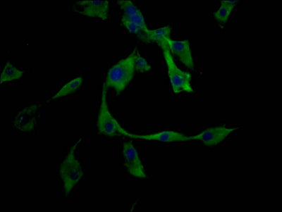 Immunofluorescence staining of U87 cell with SLAMF7 Antibody at 1:50, counter-stained with DAPI. The cells were fixed in 4% formaldehyde and blocked in 10% normal Goat Serum. The cells were then incubated with the antibody overnight at 4C. The secondary antibody was Alexa Fluor 488-congugated AffiniPure Goat Anti-Rabbit IgG(H+L).