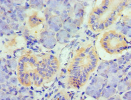 Immunohistochemistry of paraffin-embedded human pancreatic tissue using TNFSF13 Antibody at dilution of 1:100