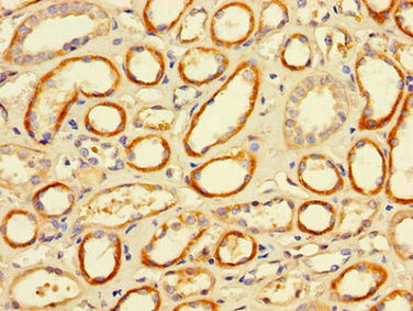 Immunohistochemistry of paraffin-embedded human kidney tissue using FCGR2A Antibody at dilution of 1:100