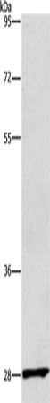 Gel: 12%SDS-PAGE, Lysate: 40 μg, Lane: Raw264.7 cells, Primary antibody: CD48 Antibody(CD48 Antibody) at dilution 1/550, Secondary antibody: Goat anti rabbit IgG at 1/8000 dilution, Exposure time: 3 minutes