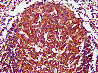 IHC image of CD27 Antibody diluted at 1:800 and staining in paraffin-embedded human lymph node tissue performed on a Leica BondTM system. After dewaxing and hydration, antigen retrieval was mediated by high pressure in a citrate buffer (pH 6.0). Section was blocked with 10% normal goat serum 30min at RT. Then primary antibody (1% BSA) was incubated at 4°C overnight. The primary is detected by a biotinylated secondary antibody and visualized using an HRP conjugated SP system.