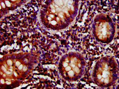 IHC image of CD27 Antibody diluted at 1:800 and staining in paraffin-embedded human appendix tissue performed on a Leica BondTM system. After dewaxing and hydration, antigen retrieval was mediated by high pressure in a citrate buffer (pH 6.0). Section was blocked with 10% normal goat serum 30min at RT. Then primary antibody (1% BSA) was incubated at 4°C overnight. The primary is detected by a biotinylated secondary antibody and visualized using an HRP conjugated SP system.