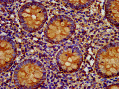 IHC image of EPCAM Antibody diluted at 1:400 and staining in paraffin-embedded human appendix tissue performed on a Leica BondTM system. After dewaxing and hydration, antigen retrieval was mediated by high pressure in a citrate buffer (pH 6.0). Section was blocked with 10% normal goat serum 30min at RT. Then primary antibody (1% BSA) was incubated at 4°C overnight. The primary is detected by a biotinylated secondary antibody and visualized using an HRP conjugated SP system.