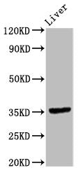 Western Blot | Positive WB detected in: Rat liver tissue | All lanes: EPCAM antibody at 9.6μg/ml | Secondary | Goat polyclonal to rabbit IgG at 1/50000 dilution | Predicted band size: 35 kDa | Observed band size: 35 kDa