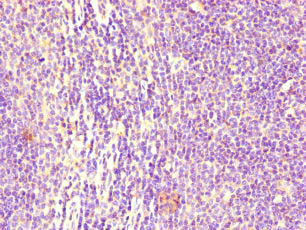 Immunohistochemistry of paraffin-embedded human lymph node tissue using FCGR2B Antibody at dilution of 1:100