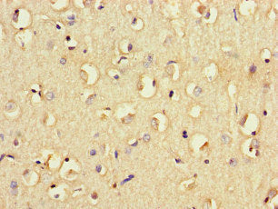 Immunohistochemistry of paraffin-embedded human brain tissue using FCGR2B Antibody at dilution of 1:100