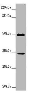 Western blot | All lanes: FCGR2B antibody at 2 μg/ml + Mouse liver tissue | Secondary | Goat polyclonal to rabbit IgG at 1/10000 dilution | Predicted band size: 35, 32, 34 kDa | Observed band size: 35, 50 kDa