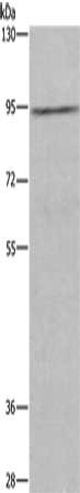 Gel: 6%SDS-PAGE, Lysate: 40 μg, Lane: Human testis tissue, Primary antibody: MUC15 Antibody(MUC15 Antibody) at dilution 1/200, Secondary antibody: Goat anti rabbit IgG at 1/8000 dilution, Exposure time: 10 seconds