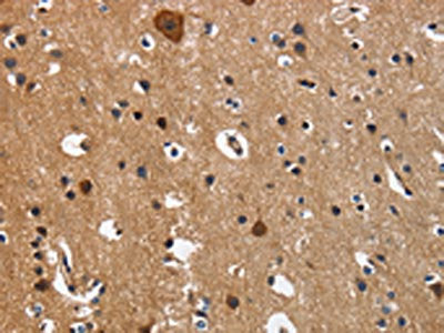 The image on the left is immunohistochemistry of paraffin-embedded Human brain  tissue using CD27 Antibody(CD27 Antibody) at dilution 1/60, on the right is treated with fusion protein. (Original magnification: ×200)