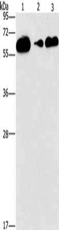 Gel: 10%SDS-PAGE, Lysate: 40 μg, Lane 1-3: Raji cells, PC3 cells, lovo cells, Primary antibody: CD27 Antibody(CD27 Antibody) at dilution 1/727, Secondary antibody: Goat anti rabbit IgG at 1/8000 dilution, Exposure time: 1 minute