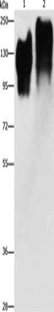 Gel: 8%SDS-PAGE, Lysate: 40 μg, Lane 1-2: Human liver cancer tissue, Human lung cancer tissue, Primary antibody: CEACAM5 Antibody(CEACAM5 Antibody) at dilution 1/350, Secondary antibody: Goat anti rabbit IgG at 1/8000 dilution, Exposure time: 30 seconds