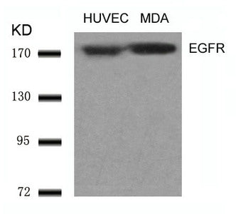 Western blot analysis of extracts from HUVEC and MDA cells using EGFR(Ab-1070) Antibody.