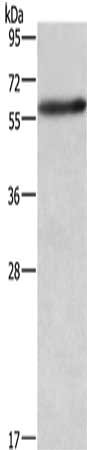 Gel: 6%SDS-PAGE, Lysate: 40 μg, Lane: A172 cells, Primary antibody: AMIGO2 Antibody(AMIGO2 Antibody) at dilution 1/597, Secondary antibody: Goat anti rabbit IgG at 1/8000 dilution, Exposure time: 5 seconds