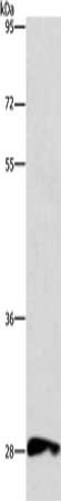 Gel: 12%SDS-PAGE, Lysate: 40 μg, Lane: Raw264.7 cells, Primary antibody: CD48 Antibody(CD48 Antibody) at dilution 1/500, Secondary antibody: Goat anti rabbit IgG at 1/8000 dilution, Exposure time: 3 minutes