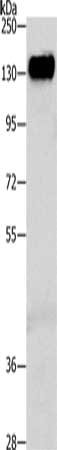 Gel: 8%SDS-PAGE, Lysate: 40 μg, Lane: Human liver cancer tissue, Primary antibody: CEACAM5 Antibody(CEACAM5 Antibody) at dilution 1/300, Secondary antibody: Goat anti rabbit IgG at 1/8000 dilution, Exposure time: 10 minutes