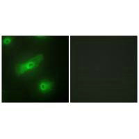 Immunofluorescence analysis of HeLa cells, using TALL-2 antibody.