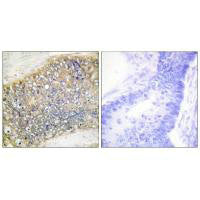 Immunohistochemistry analysis of paraffin-embedded human colon carcinoma tissue using TALL-2 antibody.