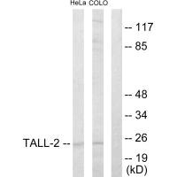 Western blot analysis of extracts from HeLa cells and COLO205 cells, using TALL-2 antibody.