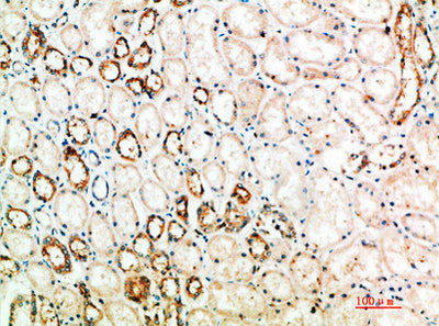 Immunohistochemical analysis of paraffin-embedded human-kidney, antibody was diluted at 1:200