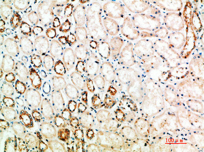 Immunohistochemical analysis of paraffin-embedded human-kidney, antibody was diluted at 1:200