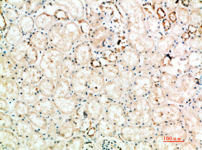 Immunohistochemical analysis of paraffin-embedded human-kidney, antibody was diluted at 1:200