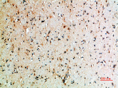 Immunohistochemical analysis of paraffin-embedded human-brain, antibody was diluted at 1:200