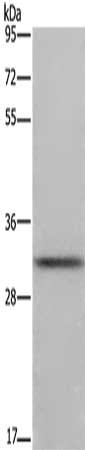 Gel: 8%SDS-PAGE, Lysate: 40 μg, Lane: Mouse brain tissue, Primary antibody: FCAR Antibody(FCAR Antibody) at dilution 1/700, Secondary antibody: Goat anti rabbit IgG at 1/8000 dilution, Exposure time: 10 seconds