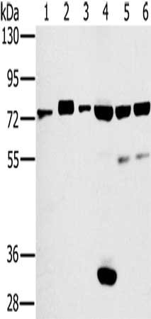 Gel: 6%SDS-PAGE, Lysate: 40 μg, Lane 1-5: Hela cells, huvec cells, mouse thymus tissue, PC3 cells, A549 cells, Primary antibody: CD44 Antibody(CD44 Antibody) at dilution 1/800, Secondary antibody: Goat anti rabbit IgG at 1/8000 dilution, Exposure time: 1 minute