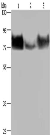 Gel: 6%SDS-PAGE, Lysate: 40 μg, Lane 1-3: HepG2 cells, human testis tissue, Hela cells, Primary antibody: PVR Antibody(PVR Antibody) at dilution 1/200, Secondary antibody: Goat anti rabbit IgG at 1/8000 dilution, Exposure time: 1 minute