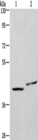 Gel: 8%SDS-PAGE, Lysate: 40 μg, Lane 1-2: SKOV3 cells, Hela cells, Primary antibody: CD47 Antibody(CD47 Antibody) at dilution 1/200, Secondary antibody: Goat anti rabbit IgG at 1/8000 dilution, Exposure time: 20 seconds