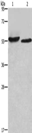 Gel: 6%SDS-PAGE, Lysate: 40 μg, Lane 1-2: SP20 cells, mouse heart tissue, Primary antibody: AMIGO2 Antibody(AMIGO2 Antibody) at dilution 1/615, Secondary antibody: Goat anti rabbit IgG at 1/8000 dilution, Exposure time: 2 minutes