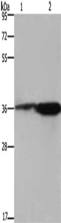 Gel: 8%SDS-PAGE, Lysate: 40 μg, Lane 1-2: 293T cells, mouse brain tissue, Primary antibody: FCAR Antibody(FCAR Antibody) at dilution 1/550, Secondary antibody: Goat anti rabbit IgG at 1/8000 dilution, Exposure time: 10 seconds