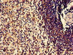 Immunohistochemistry of paraffin-embedded human spleen tissue using the antibody at dilution of 1:100