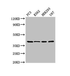 Western Blot  | Positive WB detected in: PC-3 whole cell lysate, K562 whole cell lysate, HEK293 whole cell lysate, U87 whole cell lysate  | All lanes: SLAMF1 antibody at 3μg/ml  | Secondary  | Goat polyclonal to rabbit IgG at 1/50000 dilution  | Predicted band size: 38, 34, 41 kDa  | Observed band size: 38 kDa