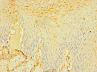 Immunohistochemistry of paraffin-embedded human tonsil tissue using CD226 Antibody at dilution of 1:100