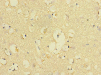 Immunohistochemistry of paraffin-embedded human brain tissue using CD226 Antibody at dilution of 1:100