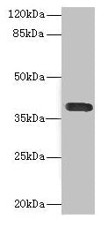 Western blot  | All lanes: CD226 antibody at 2.61µg/ml + A549 whole cell lysate  | Secondary  | Goat polyclonal to rabbit IgG at 1/10000 dilution  | Predicted band size: 39 kDa  | Observed band size: 39 kDa