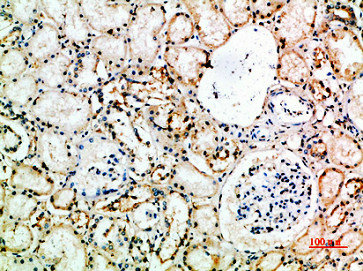 Immunohistochemical analysis of paraffin-embedded human-kidney, antibody was diluted at 1:200