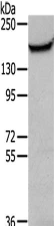 Gel: 6%SDS-PAGE,Lysate: 40 μg,,Primary antibody: MUC1 Antibody(MUC1 Antibody) at dilution 1/200 dilution,Secondary antibody: Goat anti rabbit IgG at 1/8000 dilution,Exposure time: 5 minutes