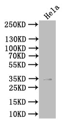 Western BlotPositive WB detected in: Hela whole cell lysateAll lanes: PVRIG antibody at 1:1000SecondaryGoat polyclonal to rabbit IgG at 1/50000 dilutionPredicted band size: 35 kDaObserved band size: 35 kDa