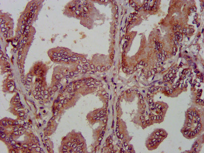 IHC image of AMIGO2 Antibody diluted at 1:800 and staining in paraffin-embedded human prostate tissue performed on a Leica BondTM system. After dewaxing and hydration, antigen retrieval was mediated by high pressure in a citrate buffer (pH 6.0). Section was blocked with 10% normal goat serum 30min at RT. Then primary antibody (1% BSA) was incubated at 4°C overnight. The primary is detected by a biotinylated secondary antibody and visualized using an HRP conjugated SP system.