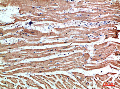 Immunohistochemical analysis of paraffin-embedded human-heart, antibody was diluted at 1:200