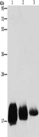 Gel: 10%SDS-PAGE, Lysate: 40 μg, Lane 1-3: Huvec cells, hela cells, SKOV3 cells, Primary antibody: CD59 Antibody(CD59 Antibody) at dilution 1/500, Secondary antibody: Goat anti rabbit IgG at 1/8000 dilution, Exposure time: 30 seconds