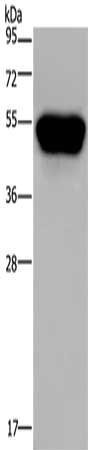 Gel: 10%SDS-PAGE, Lysate: 40 μg, Lane: Hela cells, Primary antibody: CD160 Antibody(CD160 Antibody) at dilution 1/250, Secondary antibody: Goat anti rabbit IgG at 1/8000 dilution, Exposure time: 40 seconds