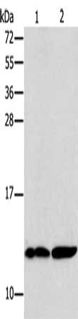 Gel: 15%SDS-PAGE, Lysate: 40 μg, Lane 1-2: Human kidney tissue, Raji cells, Primary antibody: B2M Antibody(B2M Antibody) at dilution 1/250, Secondary antibody: Goat anti rabbit IgG at 1/8000 dilution, Exposure time: 20 seconds