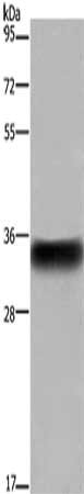 Gel: 8%SDS-PAGE, Lysate: 40 μg, Lane: Human placenta tissue, Primary antibody: FCGR2B Antibody(FCGR2B Antibody) at dilution 1/850, Secondary antibody: Goat anti rabbit IgG at 1/8000 dilution, Exposure time: 5 seconds