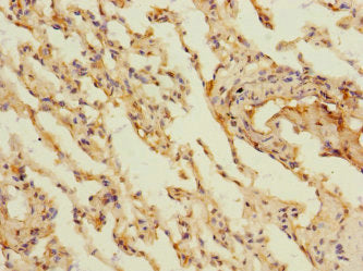 Immunohistochemistry of paraffin-embedded human lung tissue using MARCO Antibody at dilution of 1:100