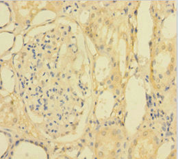 Immunohistochemistry of paraffin-embedded human kidney tissue using the antibody at dilution of 1:100