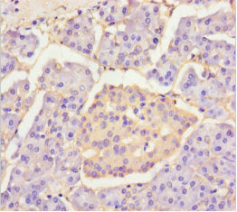 Immunohistochemistry of paraffin-embedded human pancreatic tissue using PLA2G2D Antibody at dilution of 1:100