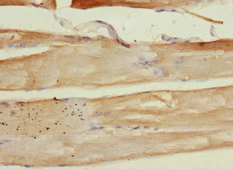 Immunohistochemistry of paraffin-embedded human skeletal muscle tissue using PLA2G4C Antibody at dilution of 1:100